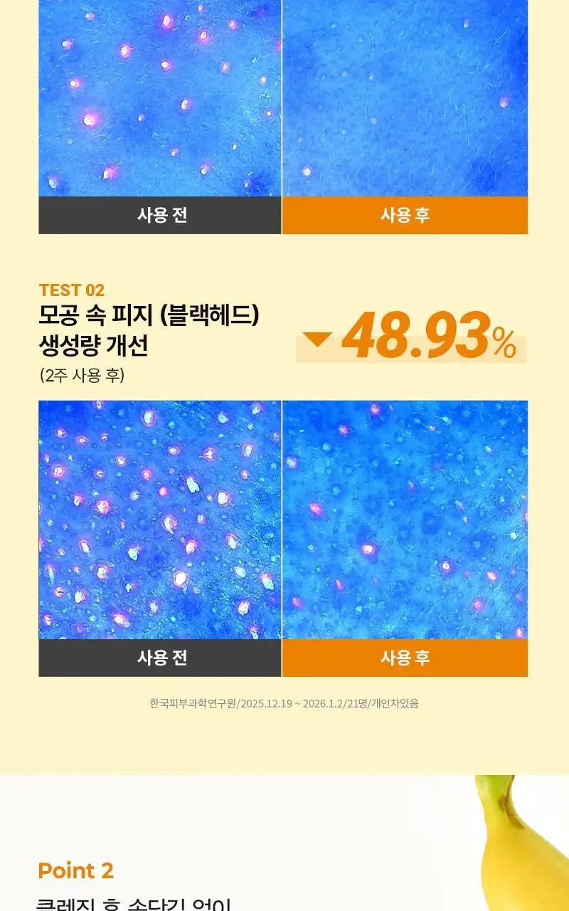 [민감보습/블랙헤드방어] 한스킨 클렌징 바나나밀크&블랙헤드 PHA 200ml (기획/단품) 상세페이지 9